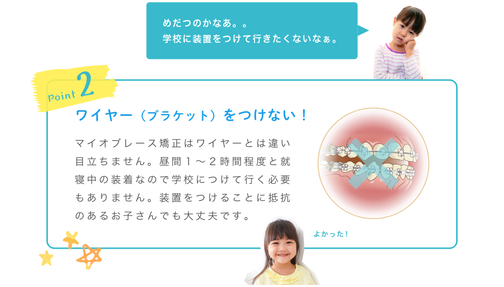 ポイント2ワイヤーをつけない