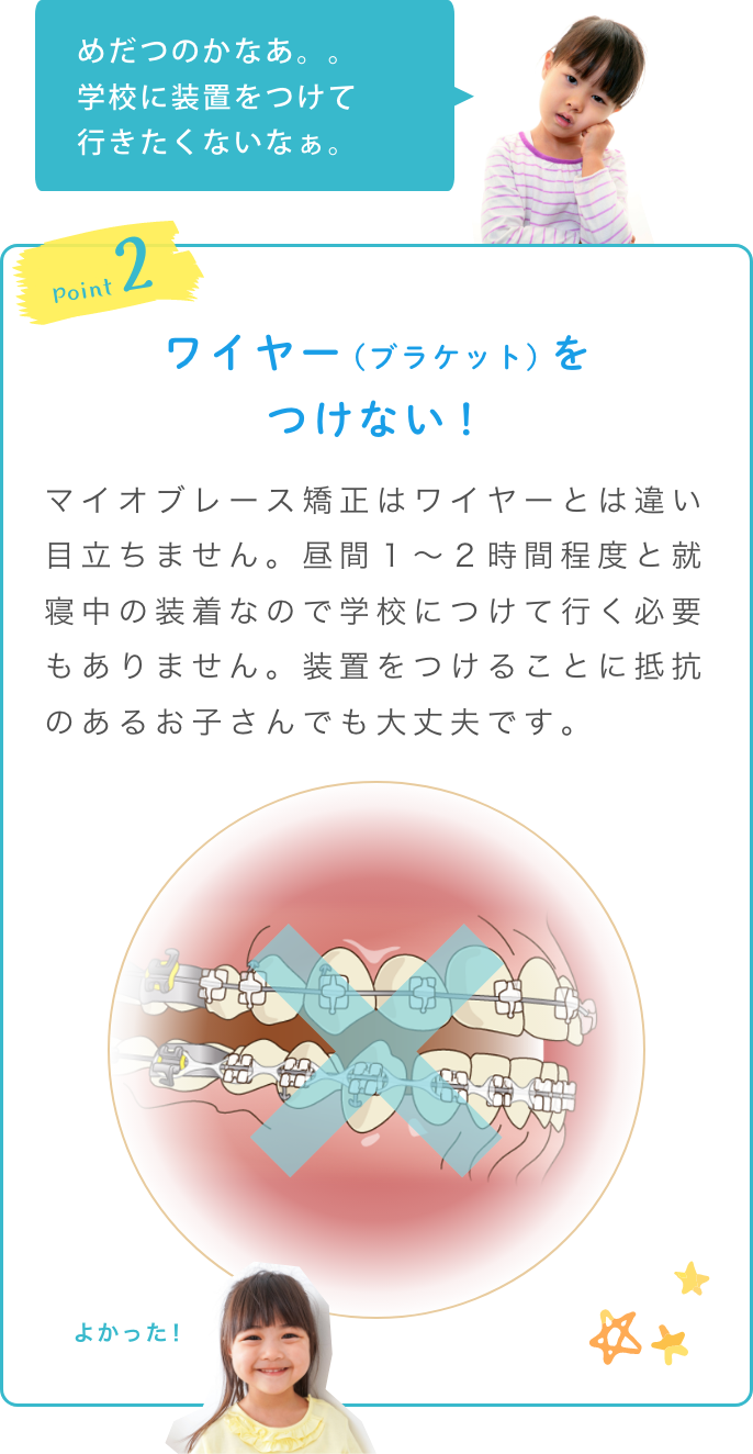 ポイント2ワイヤーをつけない