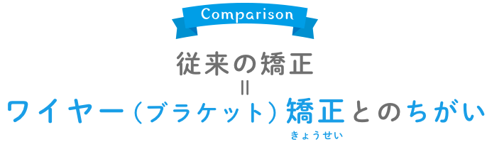 ワイヤー矯正とのちがい