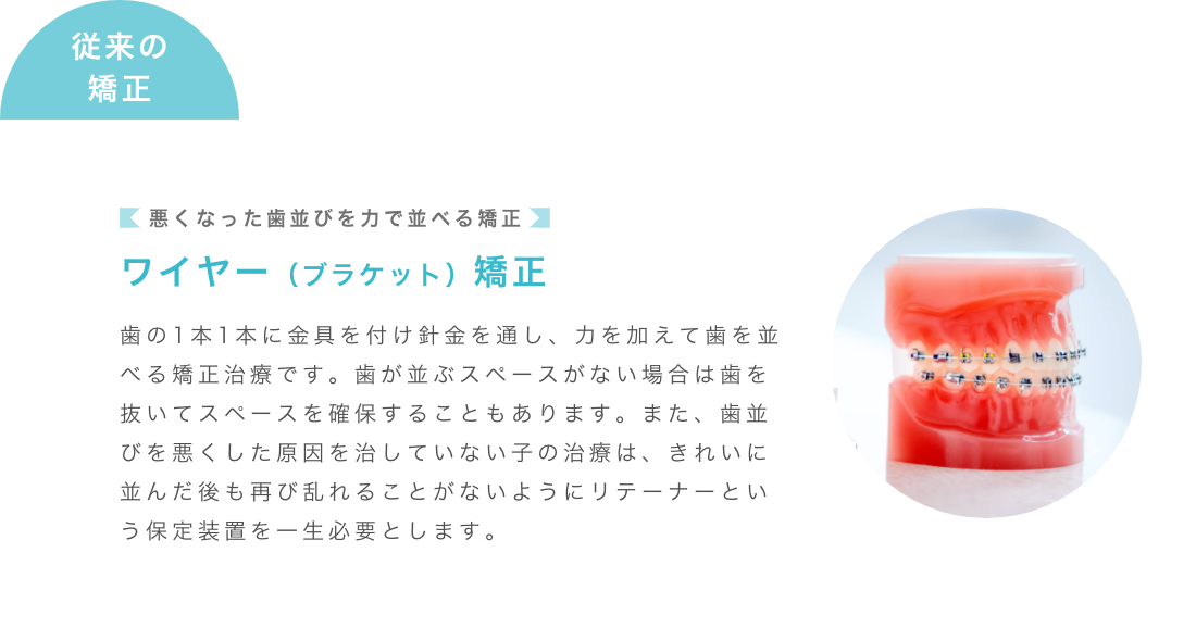 従来の矯正は悪くなった歯並びを力で並べる矯正