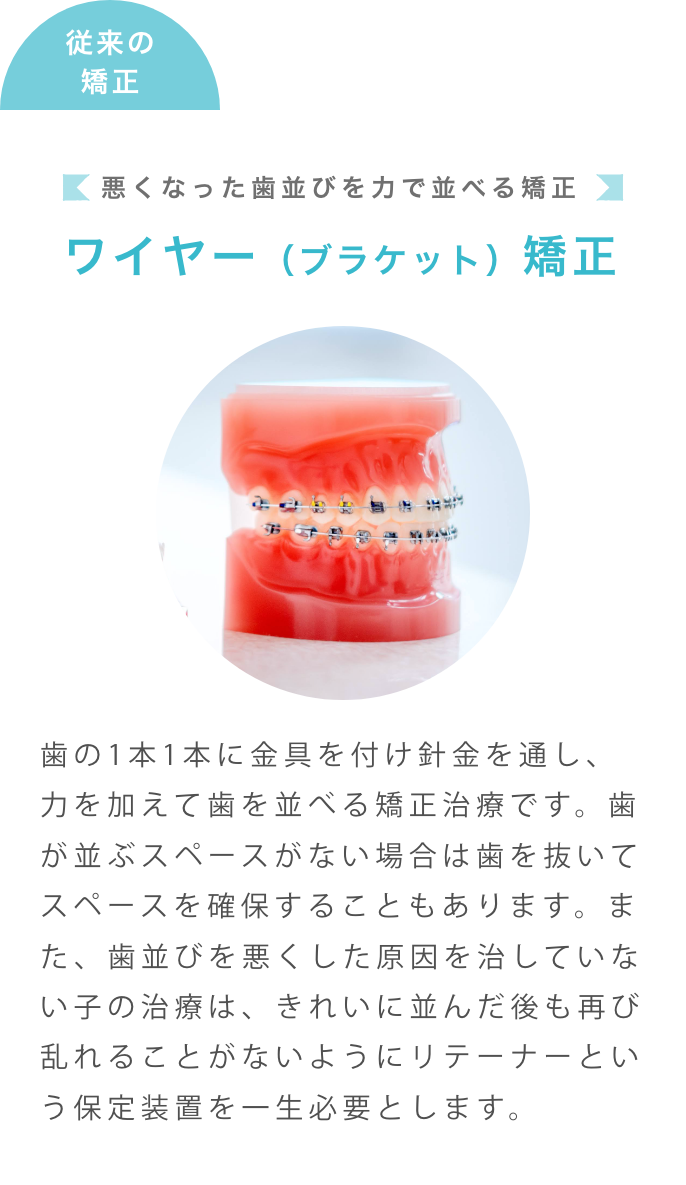 従来の矯正は悪くなった歯並びを力で並べる矯正