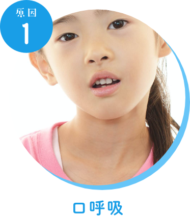 原因1口呼吸