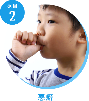 原因2悪癖
