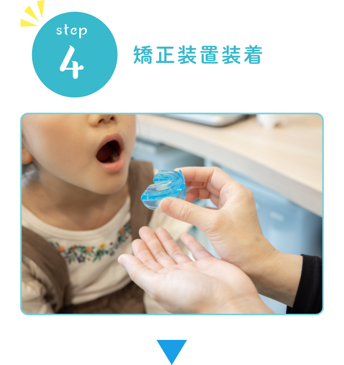 step4矯正装置装着